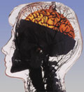 Health Seminar How to Train your Abdominal Brain 4 December 2009 Auckland